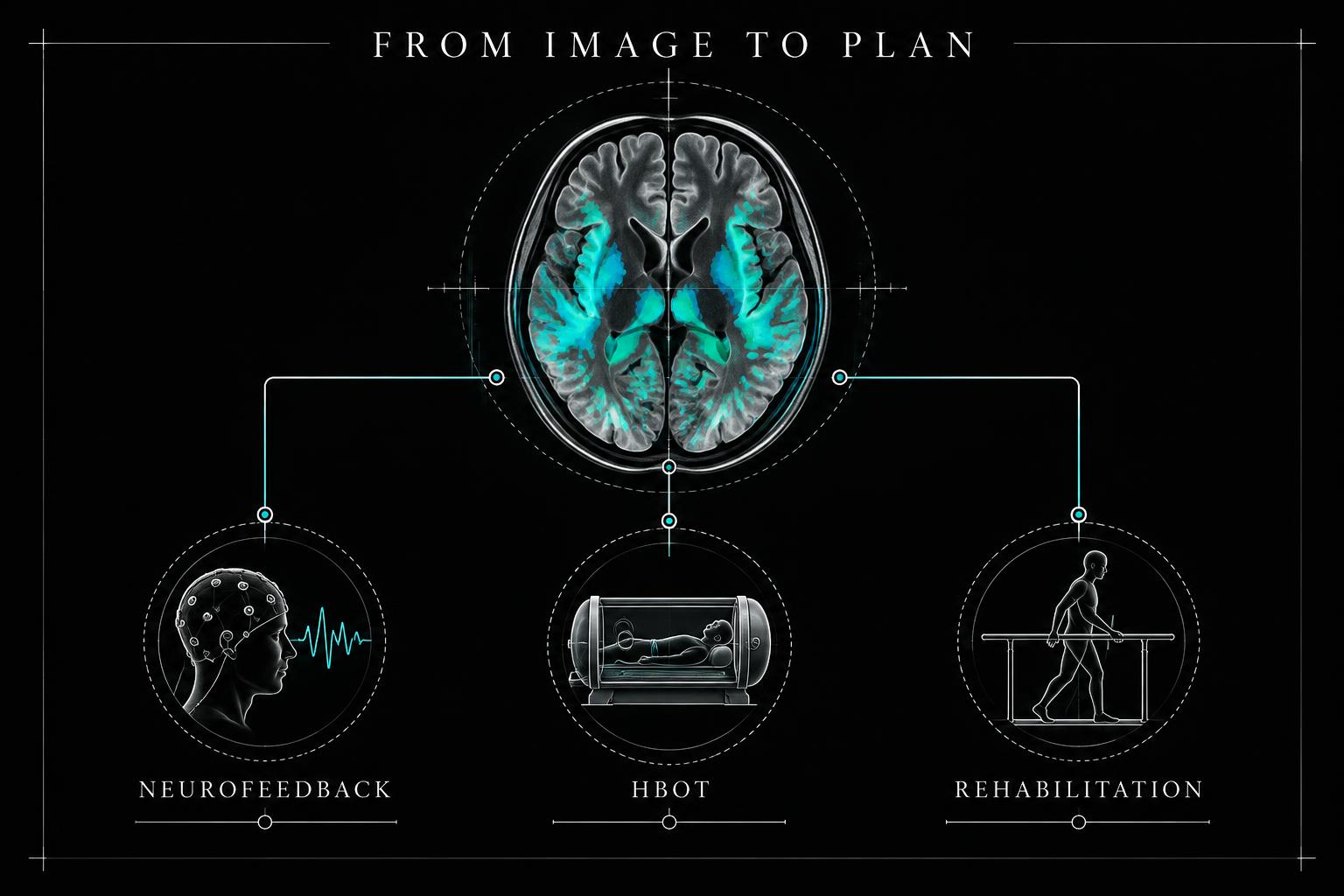 A functional brain scan connected to neurofeedback, hyperbaric oxygen therapy, and rehabilitation pathways.